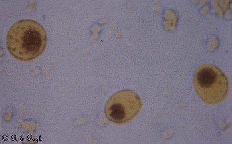 4. Entamoeba coli 1.