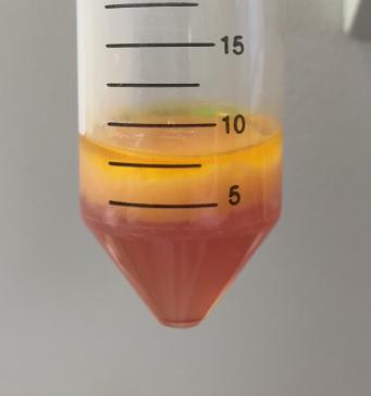 Derived stem cells were grown and differentiated following protocols used routinely in the Ferretti laboratory (Fig.2). A Figure 1. (A) Lipoaspirate washed before seeding onto culture plates.