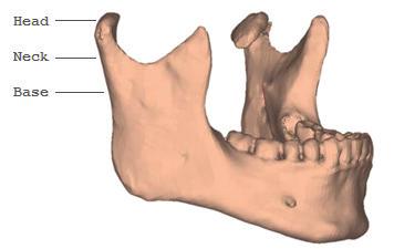 General introduction Anatomy of the mandibular condylar process The mandibular condylar process is the bilateral proximal part of the mandible, consisting of the condylar head, the condylar neck and