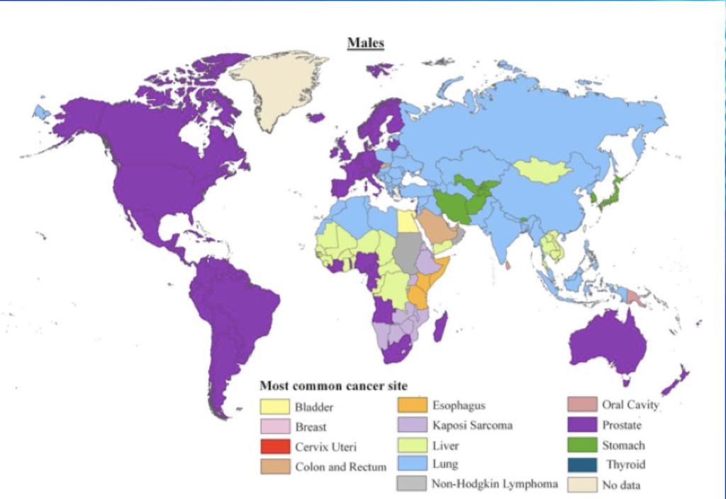 Lung cancer is the leading cancer in eastern