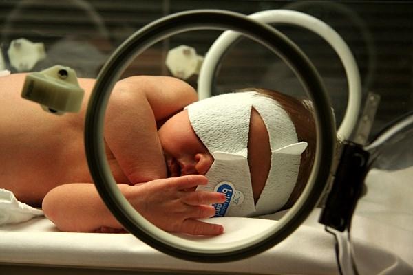 Ultra Violet Lamp MRI scanner Used to stop jaundice in babies helping the tiny liver clean
