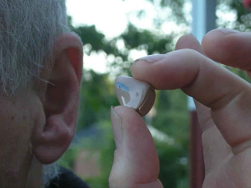 Hearing Aid Cochlea Implant Small battery powered transistors that amplify