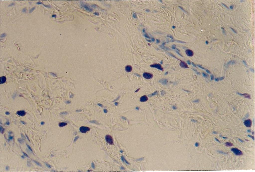 Note the granules dispersed in the adjacent connective tissue(toluidine Blue,40 x) with a blood