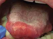 1Here s an image of the hard palate.