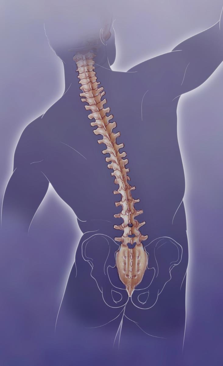 Reference Guide for PACU Lumbar Fusion CLINICAL PATHWAY All patient variances to the pathway are to be circled and addressed in the progress notes.
