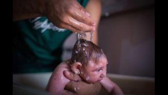 May 17, 2017 43 Study: Zika Virus (ZKV) Infection in Pregnant Women in Rio de Janeiro 345 women enrolled from September 2015 through May 2016; of these, 182 (53%) women tested positive for ZIKV in
