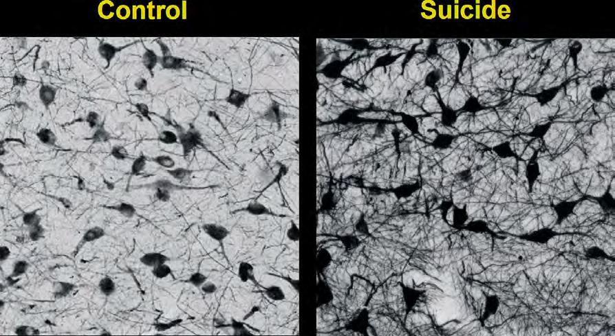Serotonin Neurons and Serotonin Content Postmortem studies of MDD suicides: More