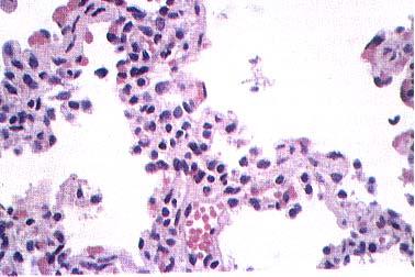 which may be useful in identifying the specific agent if tissue biopsies are taken.