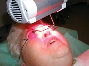 What is photodynamic therapy?