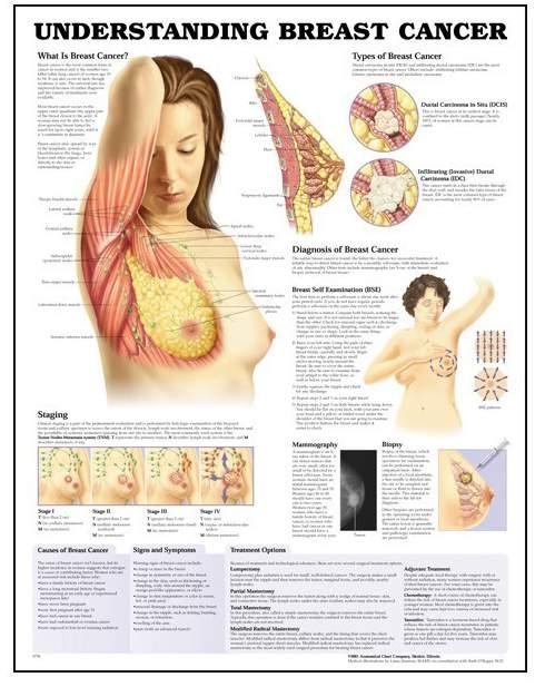 Understanding Breast Cancer B04535 An A2 laminated poster showing the anatomical