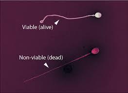 EOSIN-NIGROSIN Sperm viability Done on all specimens having a motility <25% It is