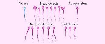 SPERM MORPHOLOGY Sperm morphology is an