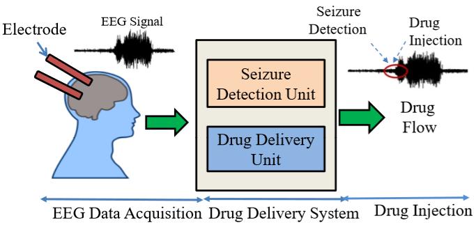 Epileptic Seizure Detection and