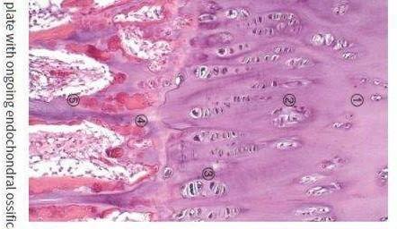 The picture shows the histology of articulating cartilage (growth plate), look to the: chondrocytes subchondral plate bone