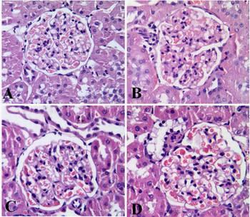 Figure 1B showed kidney of rat from the positive control group (DN group) with slightly increased glomeruli, thickened glomerular basement membrane, widening mesangial, and vacuolated epithelial