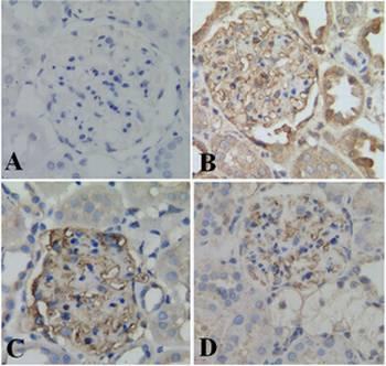 Effect of TG on expressions of MCP-1 and CTGF in kidney tissues To investigate the effect of TG on expression of MCP-1 and CTGF in DN rats, immunohistochemistry, western blot and PCR analysis were