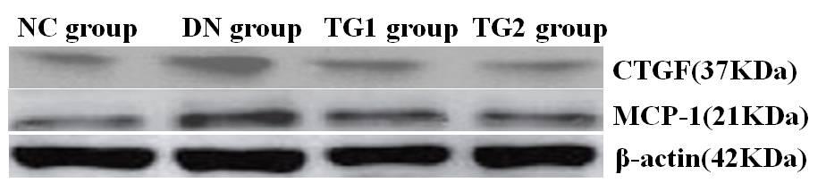 largely localized to the glomerular and tubulointerstitial; (C) TG1 group: Treating DN rats with TG (5 mg/kg/d) reduced the