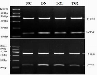 Western blots for CTGF and MCP-1 in the kidney Figure 6: Effect of TG treatment on the expressions of CTGF and MCP-1 mrna in the