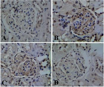 Figure 7: Immunohistochemical staining of ED-1 in the kidney of different groups (400 magnification); (A) NC group: Kidney of the rats showed small amount of brown immunopositive deposits; (B) DN