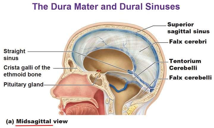 attachment to the petrous bone, and the transverse sinus along its attachment to the occipital bone.