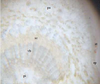 Hill Microscopic studies The microscopic characters of the leaf are presented in fig 2a and fig 2b.
