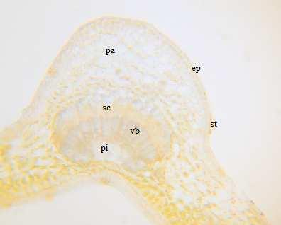 The outer walls of which are cuticularished only covering trichomes emerge from the epidermal layer. A few stomata are seen on the upper epidermis.