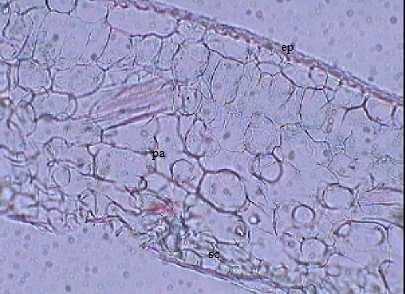 Fig 2c. Epicarp and mesocarp Fig 2a: Microscopic characters the of leaves of M.