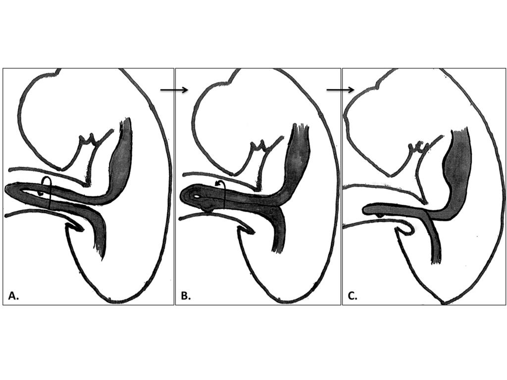 Fig. 2: Illustration of the first 90 counter-clockwise rotation from a lateral point of view.