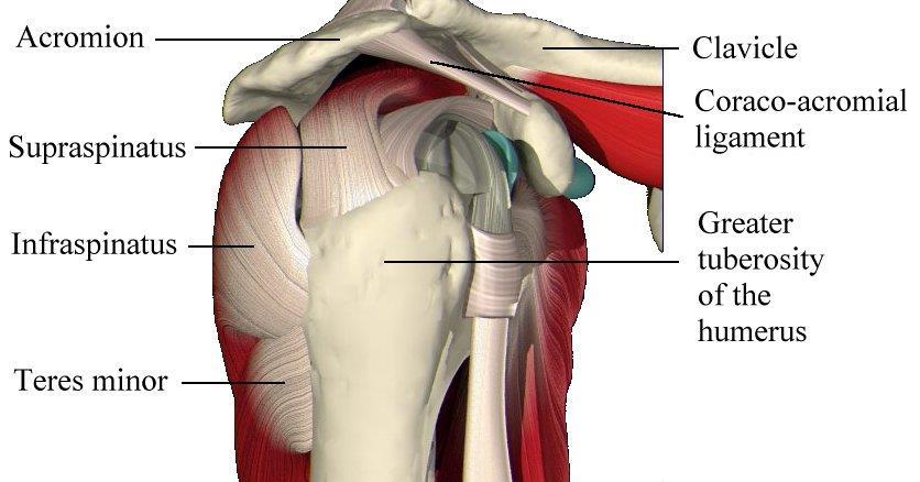 Side view of the right shoulder Your tendons can get damaged in two ways, either by an accident, or by weakening and "wearing out" over time.