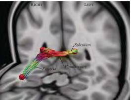 MULTIPLE STUDIES SHOW ALTERED BRAIN STRUCTURE AND FUNCTION IN