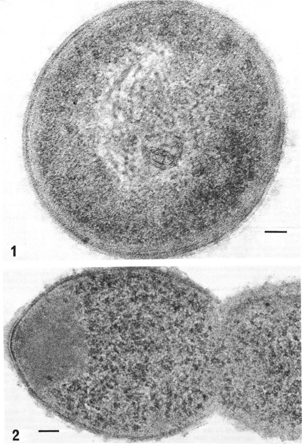 FIG. 2. Optochin-resistant 70 pneumococcus incubated at 37 C for 30 min with 500 lag of optochin hydrochloride per ml.