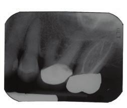 The use of three dimensional imaging utilizing cone beam computed tomography (CBCT) is the newest innovation which has revolutionized various aspects of planar imaging.