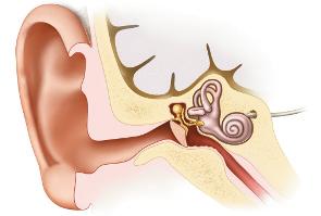 They make the sound louder. The sound then goes to the cochlea. The cochlea sends the sound through the auditory nerve to the brain.