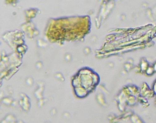 vessels of Nagarmotha (Image:13), sclereids of Murva (Image:14), prisum of Murva (Image:15), rhombidal crystal of Murva (Image:16), colenchyma cells of Guduchi (Image:17), cork cells in surface view