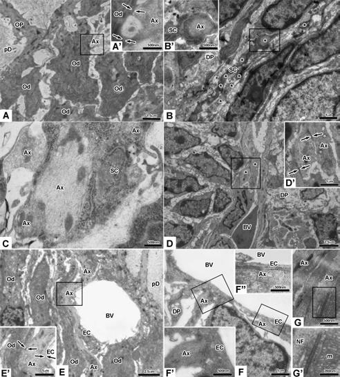 350 Cells and Biomaterials in Regenerative Medicine Figure 3. Transmission electron microscopy of cell re-associations implanted for two weeks in Nude mice (A-D ) and first lower molar at PN7 (E-G ).