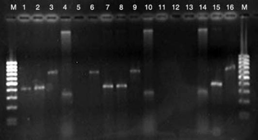 Fig. 2. Multiplex-PCR for identification of FMDV serotypes.