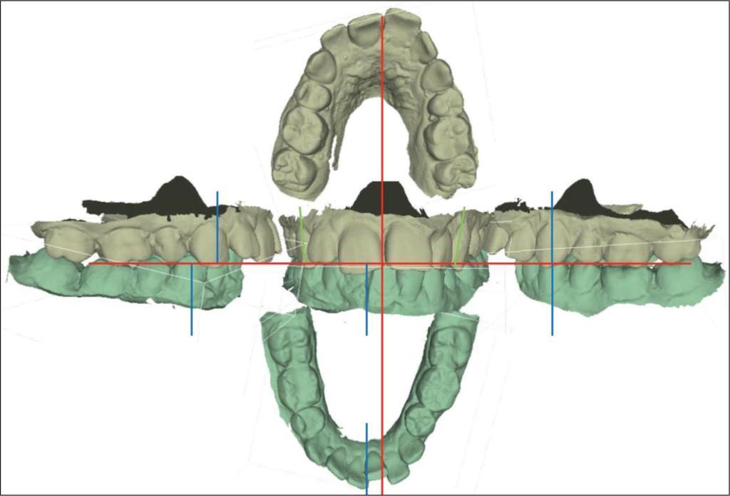 Combined use of digital imaging technologies: ortho-surgical treatment Figure 4 Asymmetry and