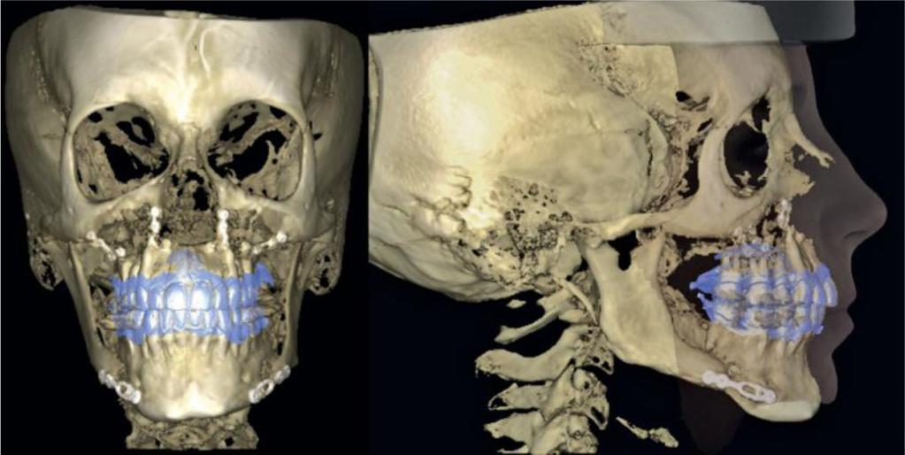 b) Profile evolution by looking at preand post-surgical photographs.