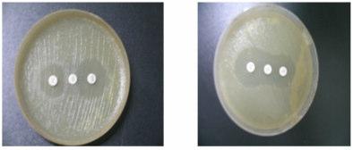 coli 25922 was inoculated on the surface of Mueller-Hinton agar plate. A 30 g cefoxitin disc was placed on the inoculated surface of the agar.