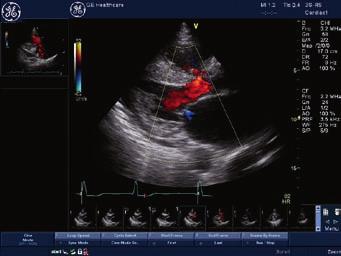 Enhanced, real-time definition gives you the clinical confidence you ve been waiting for in a compact, convenient and economical ultrasound system.