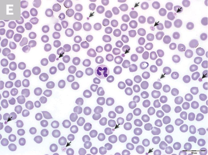 Platelets Help blood clot