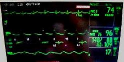 Figure 2 Image 2: Some vital signs such as blood pressure, amount of oxygen in the blood (so-called saturation) and heart rate will be measured before and during insertion of the catheter HOW DO I