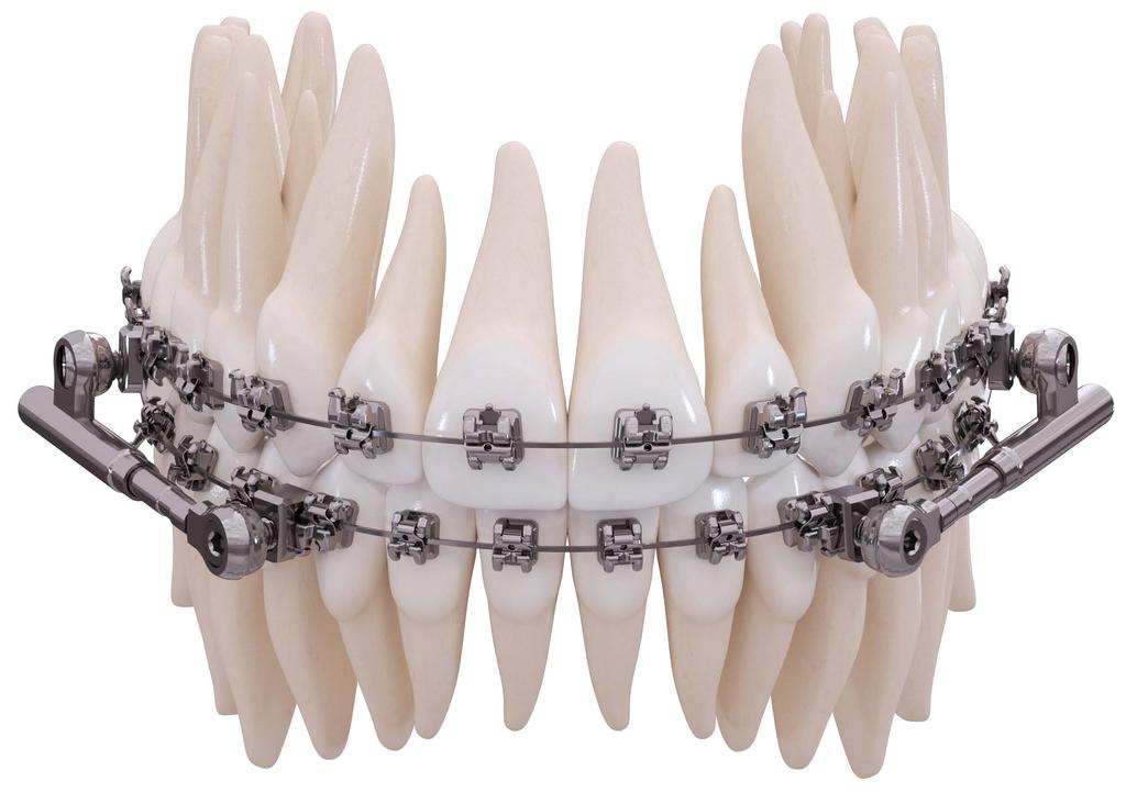 American Orthodontics ensures the highest quality standards through extensive in-house