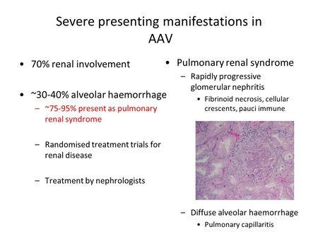 6 di 23 So, we know as nephrologists that renal involvement in ANCA-associated vasculitis is common, it s the most common severe manifestation with 78% of patients having renal involvement at