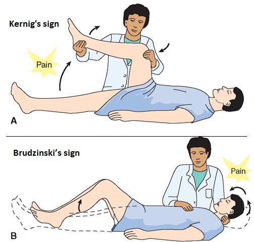 patient of meningitis will have stiffed neck, Kernig s sign and Brudzinski s sign because if he stretched his meninges he will feel pain. What are Kernig s sign and Brudzinski s sign?
