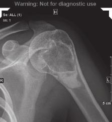 3) and the postoperative radiograph (Fig. 4).