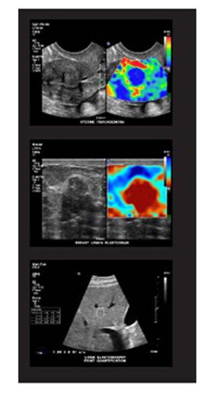 for GLS and EF PureWave offers enhanced technology for imaging