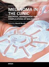 Melanoma in the Clinic - Diagnosis, Management and Complications of Malignancy Edited by Prof.