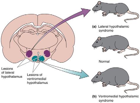 The Hypothalamus and Feeding Anorexia Severely diminished appetite for food Obesity Overeating caused by
