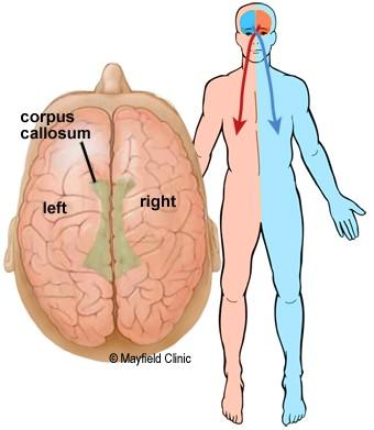 controls the opposite side of the body If a stroke occurs on the